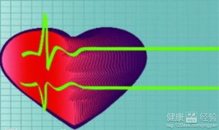 得了心肌梗死怎麼辦