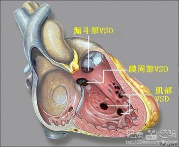 第1步