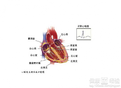 心肌缺血怎麼辦囊？