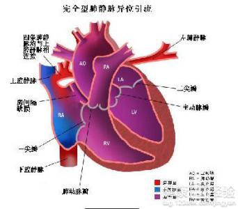 窦房傳導阻滯預防