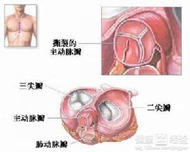 第1步