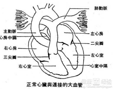 風濕性心髒病如何護理