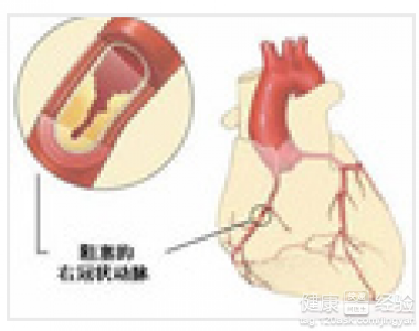 第1步