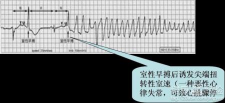 第2步