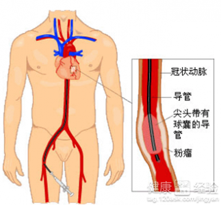 第2步