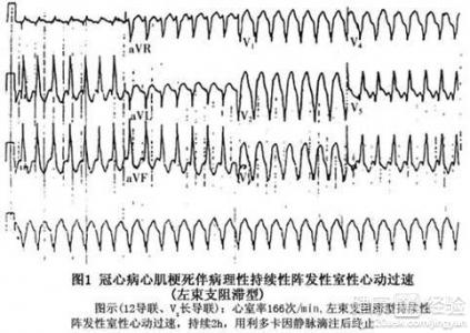 第1步