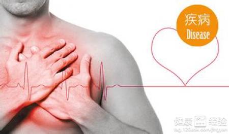 心前區有刺痛感是心絞痛嗎