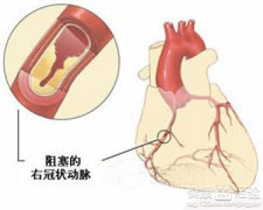 第2步