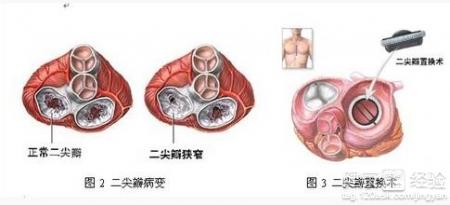 第1步