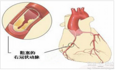 心悸發冷眩暈氣短是什麼病