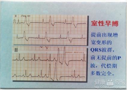 第5步