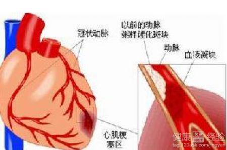 第3步