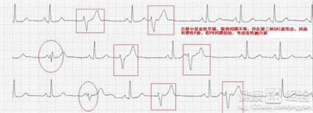 第1步