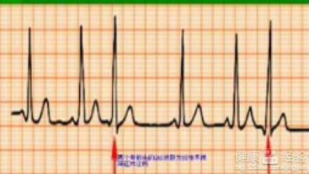 第1步