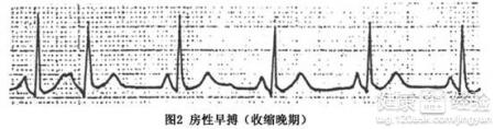 第2步