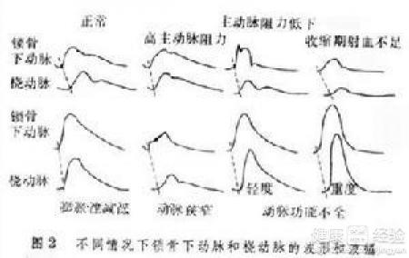 第1步