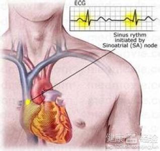 窦性心律過緩心房室早搏怎麼辦