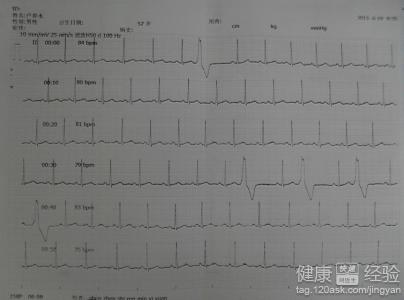 第1步