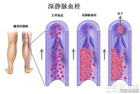 第1步