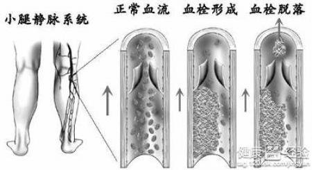 第1步