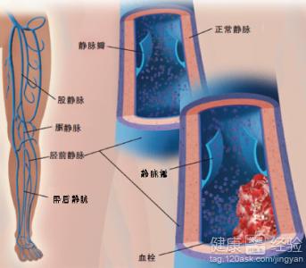 第1步