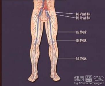 左髂靜脈血栓一年半怎麼治療好