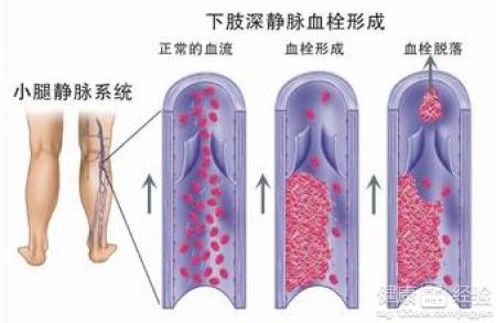 第1步