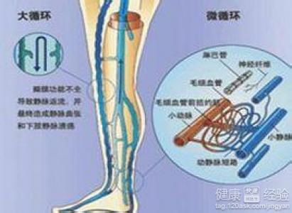 腸系膜靜脈血栓腸壞死是什麼病