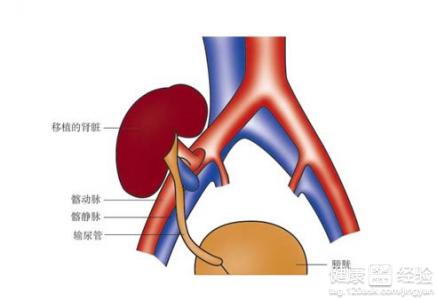 第2步