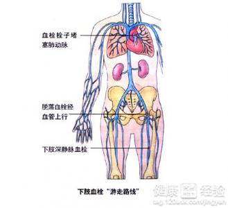 第1步