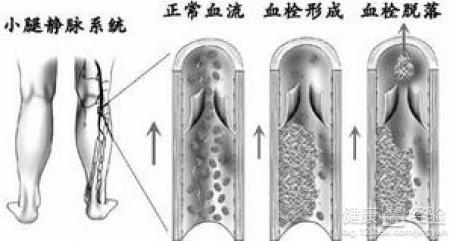 第1步