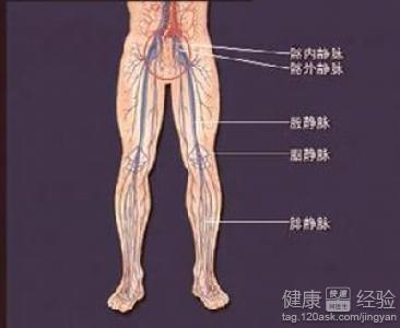 左下肢靜脈血栓需要治療嗎