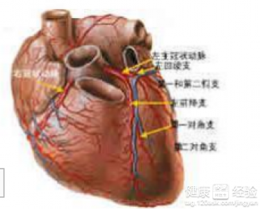 怎樣治療冠狀動脈粥樣硬化