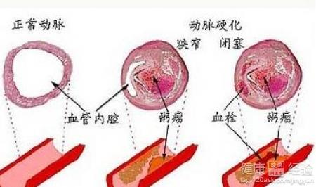 第1步