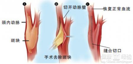 第2步