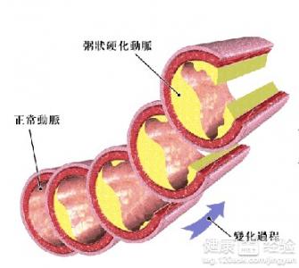 第1步