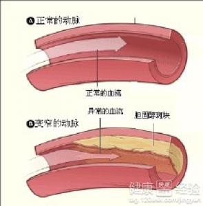 第1步