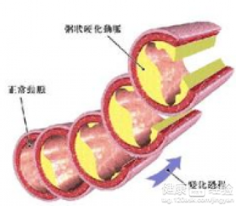 第1步