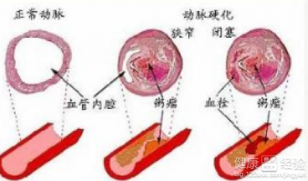 第1步