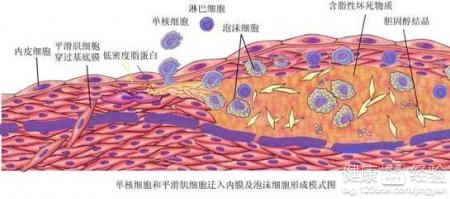 第1步