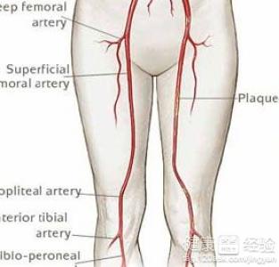 下肢動脈硬化的症狀