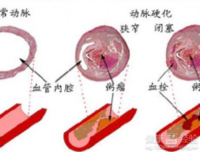 第1步