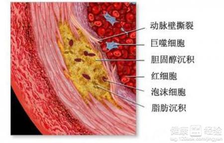 第2步