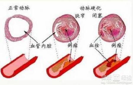 第1步