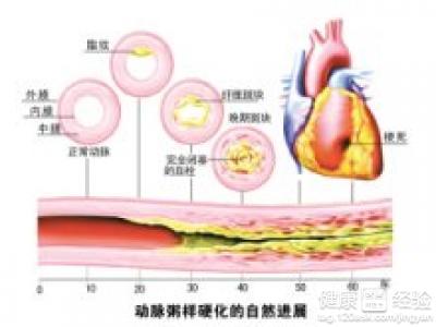 第1步