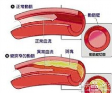 第2步