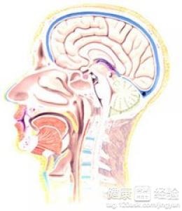 腦動脈硬化診斷治療