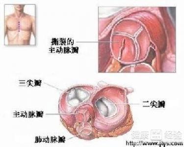 第1步