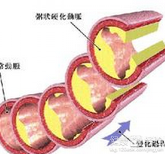 第1步