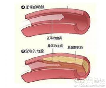 第1步